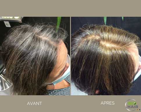 avant-après-brun.jpg avant-après-brun.jpg