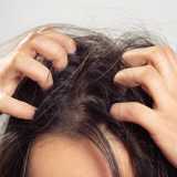 demangeaison-shampoing-solide.jpg demangeaison-shampoing-solide.jpg